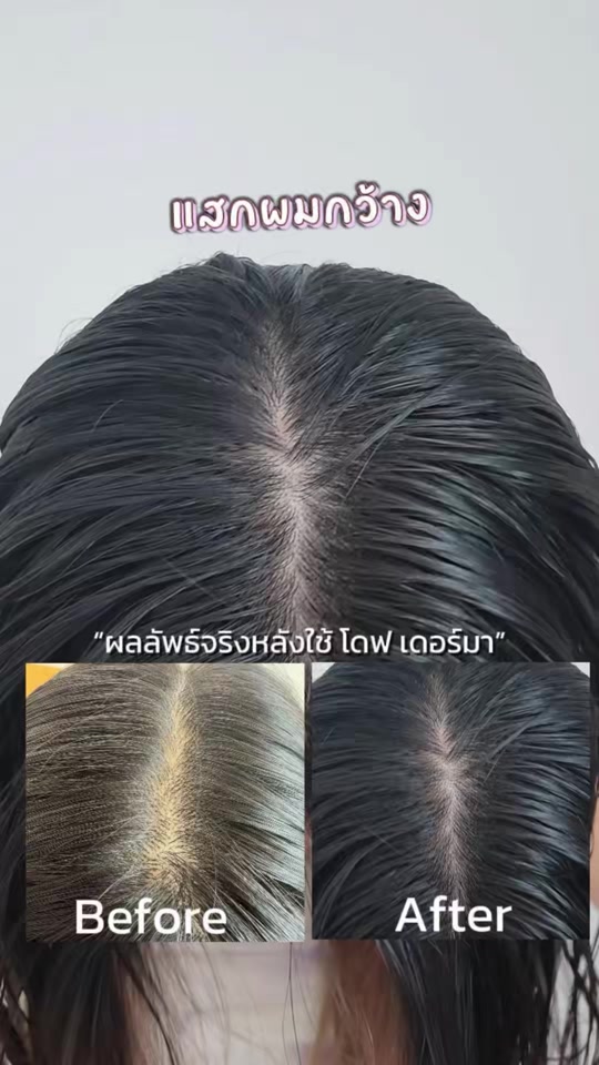 @มุกกิทั่วทีปทั่วแดน