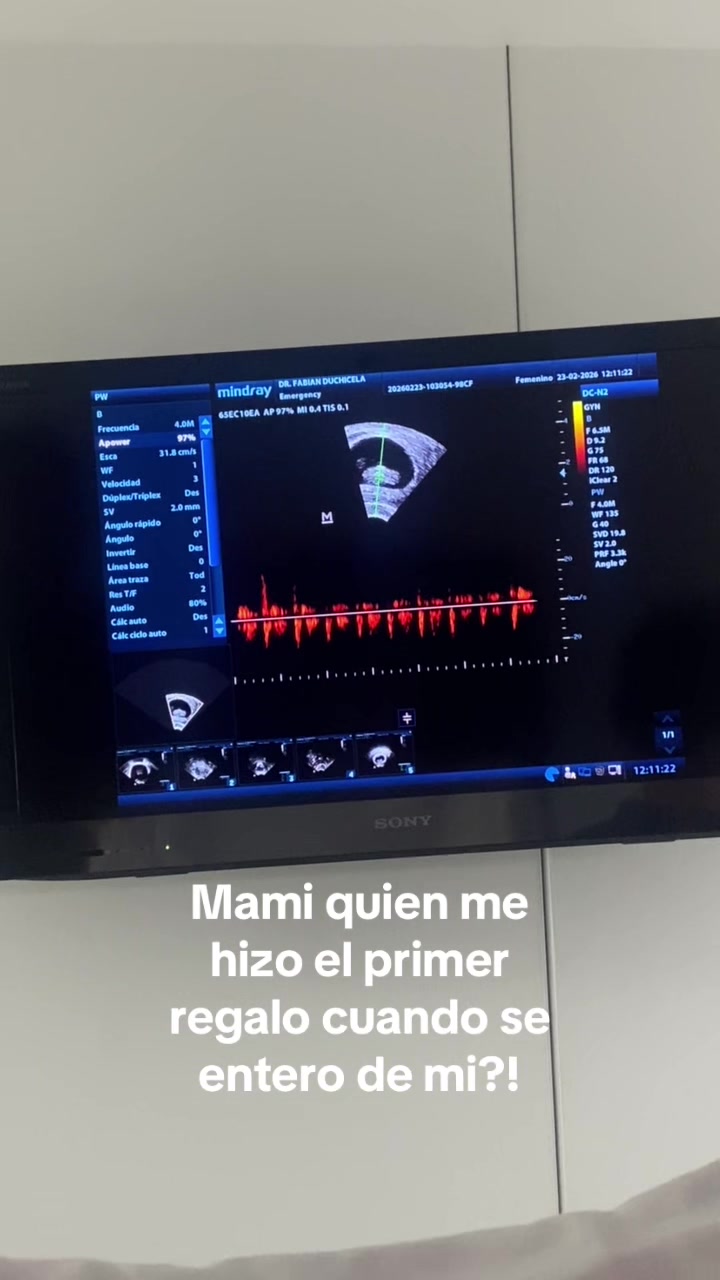 @Dino Raptor ec