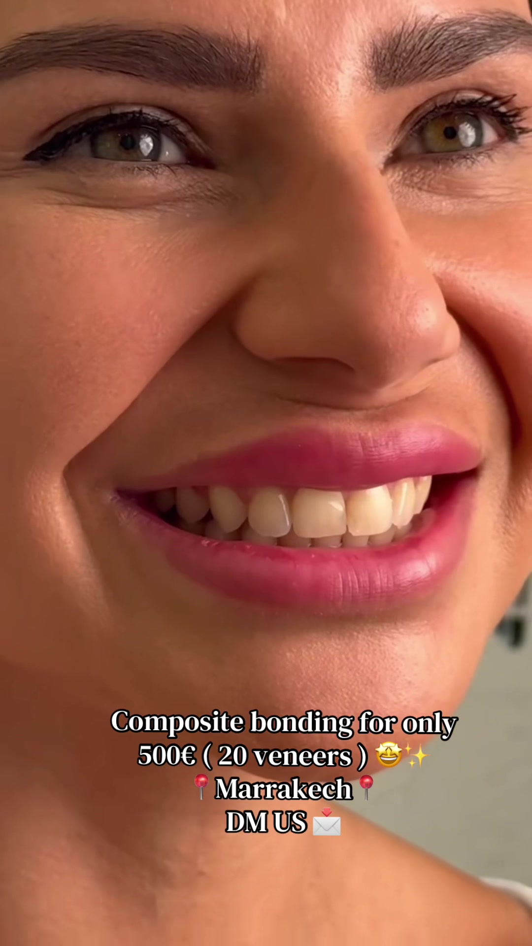 @Smilesecret