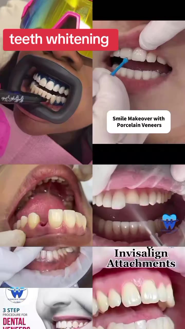 @celemoxic dental clinic