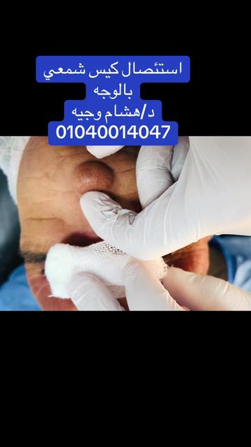 @Dr Hesham Wageh