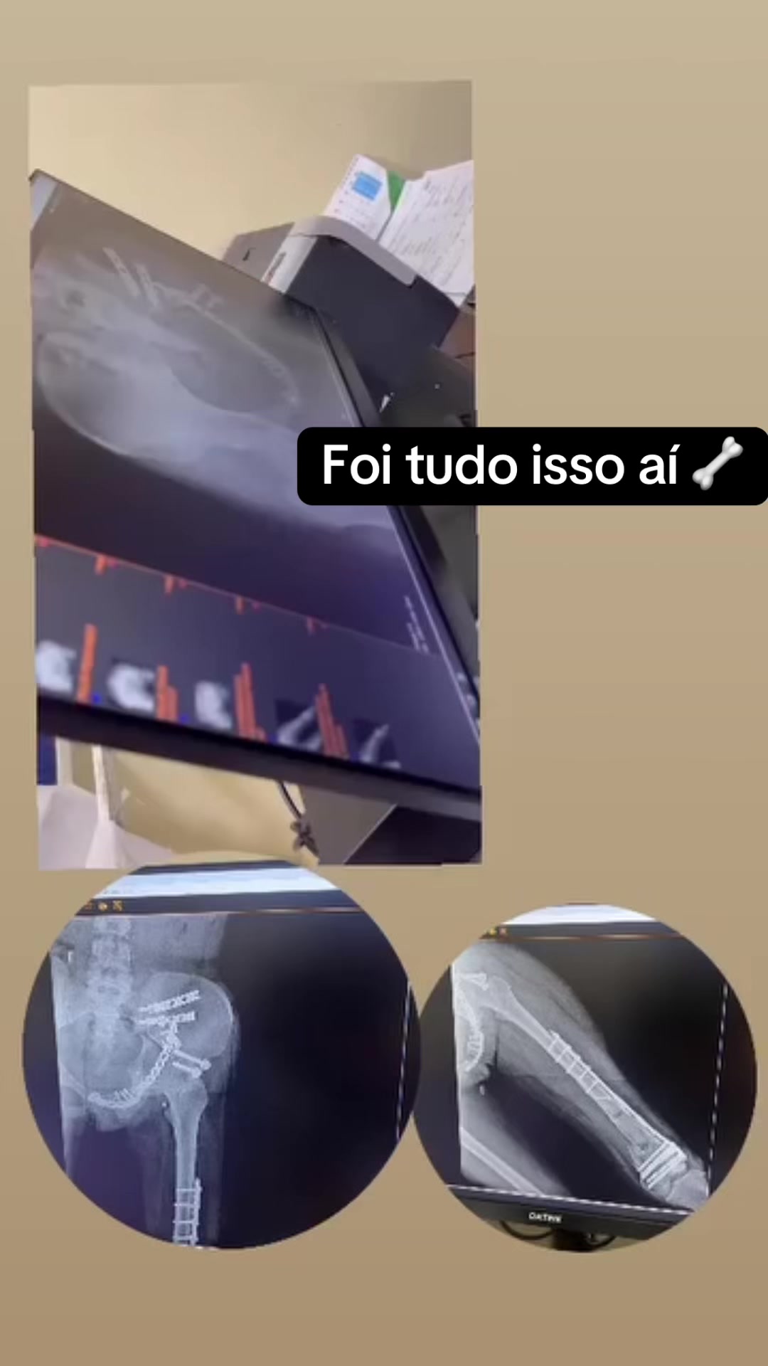 @Mari