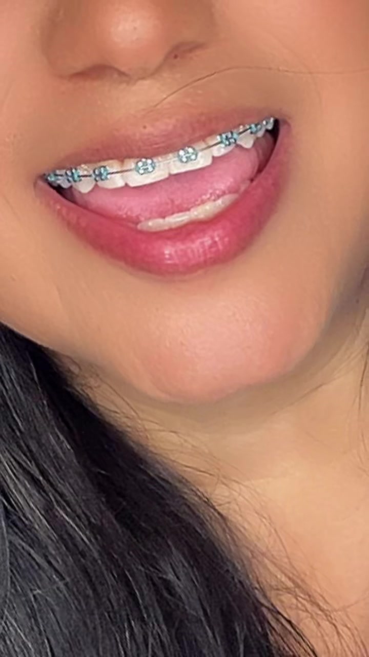 @🐺🌖🇨🇴𝕯𝖊𝖓𝖎𝖆2240🪗