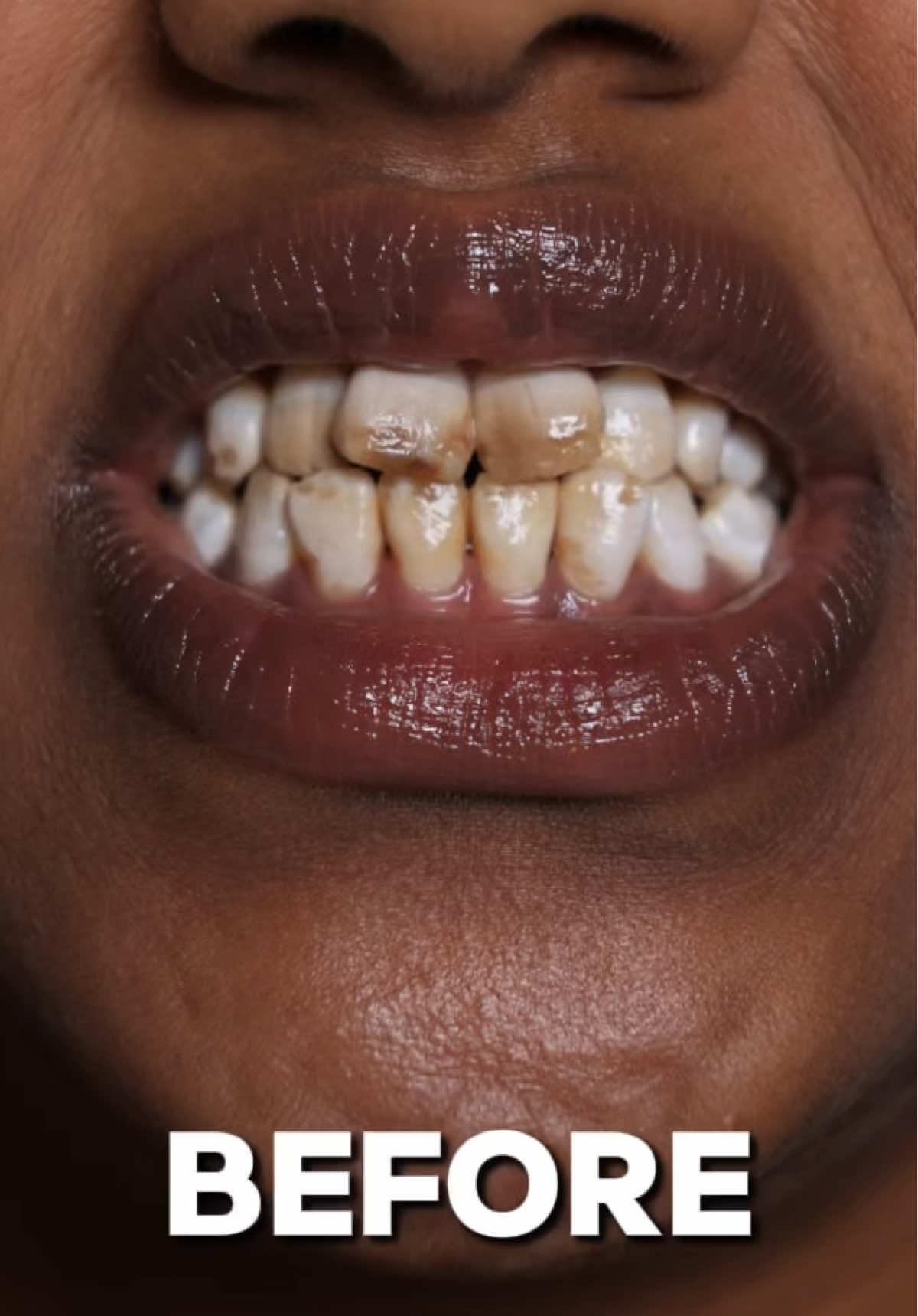 @drhelina_smile_architect