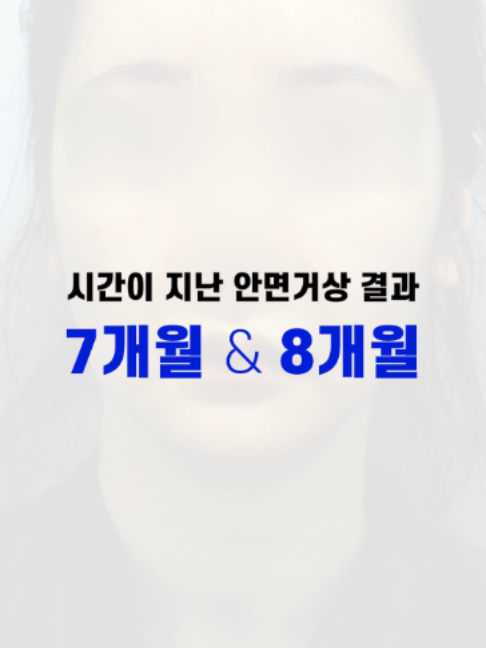 @다시피움성형외과 DASIPIUM タシピウム