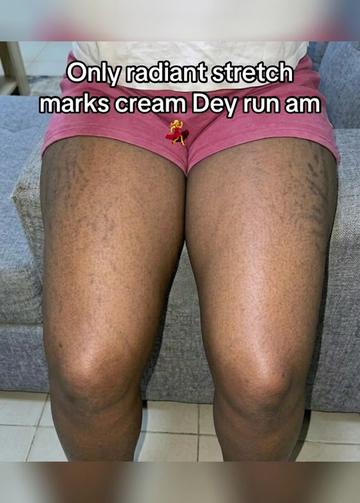 @Radiant skin