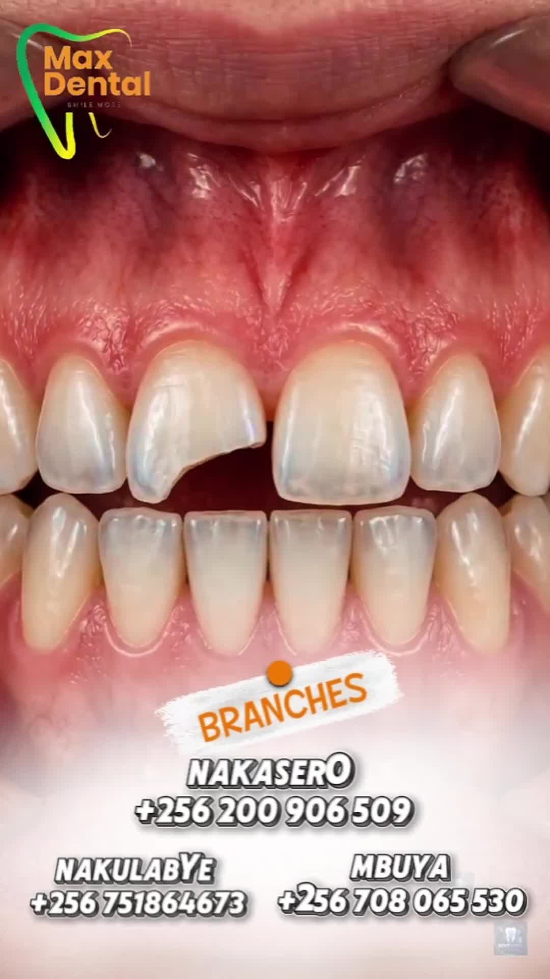 @MAX DENTAL CLINICS