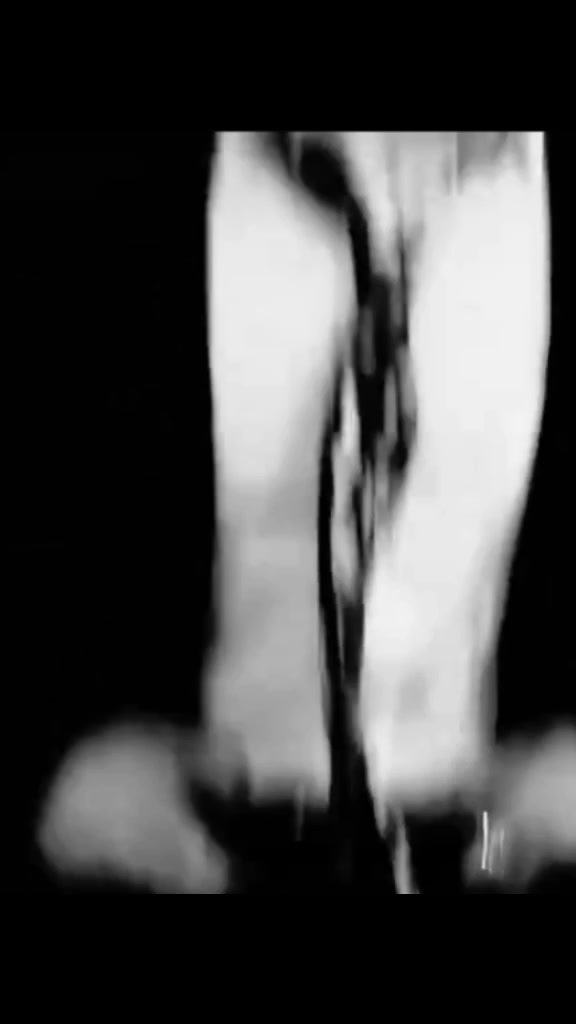 @ヅDᴵᴸ Tᴼᴿ ᴷᴵᴸᴸᴱᴿ 💔