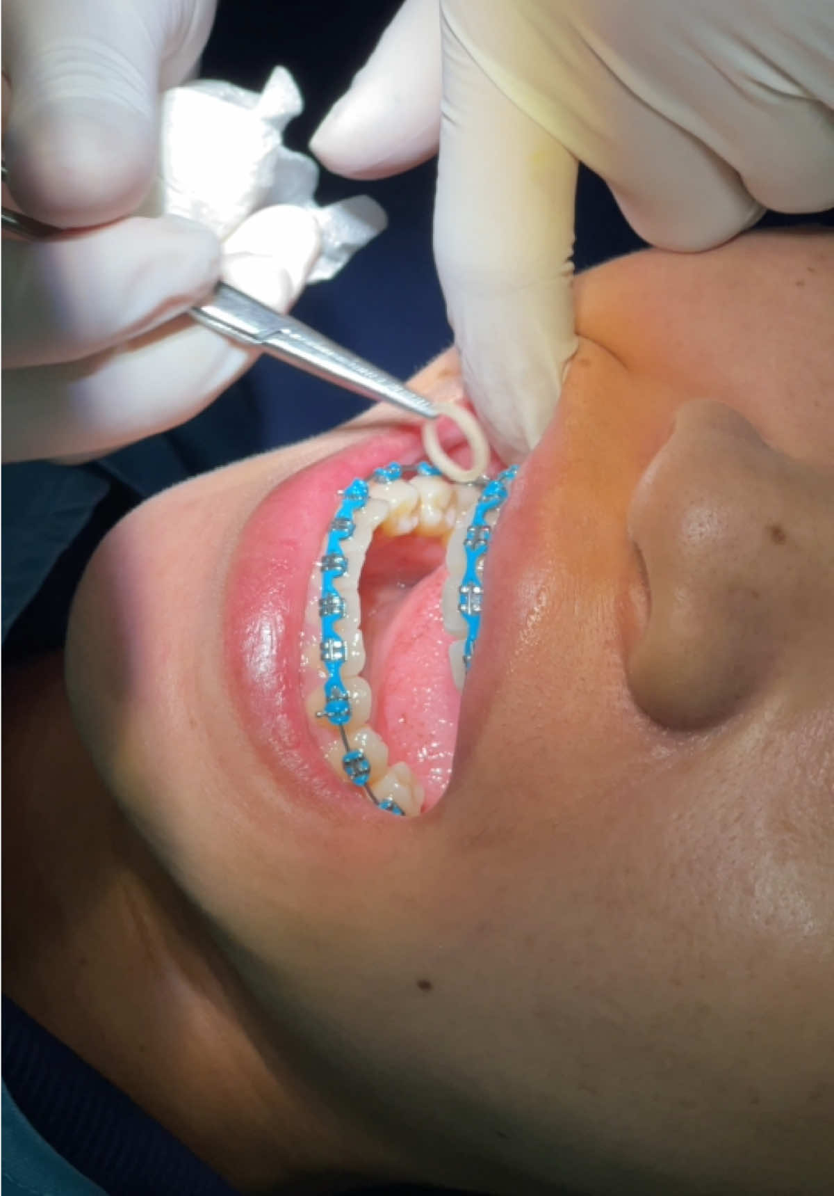 @BRIGHT SMILE DENTAL HOSPITAL