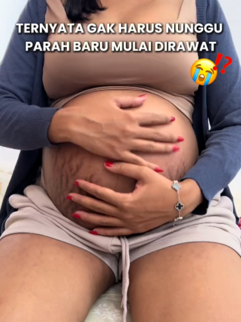 @Ciara Indonesia