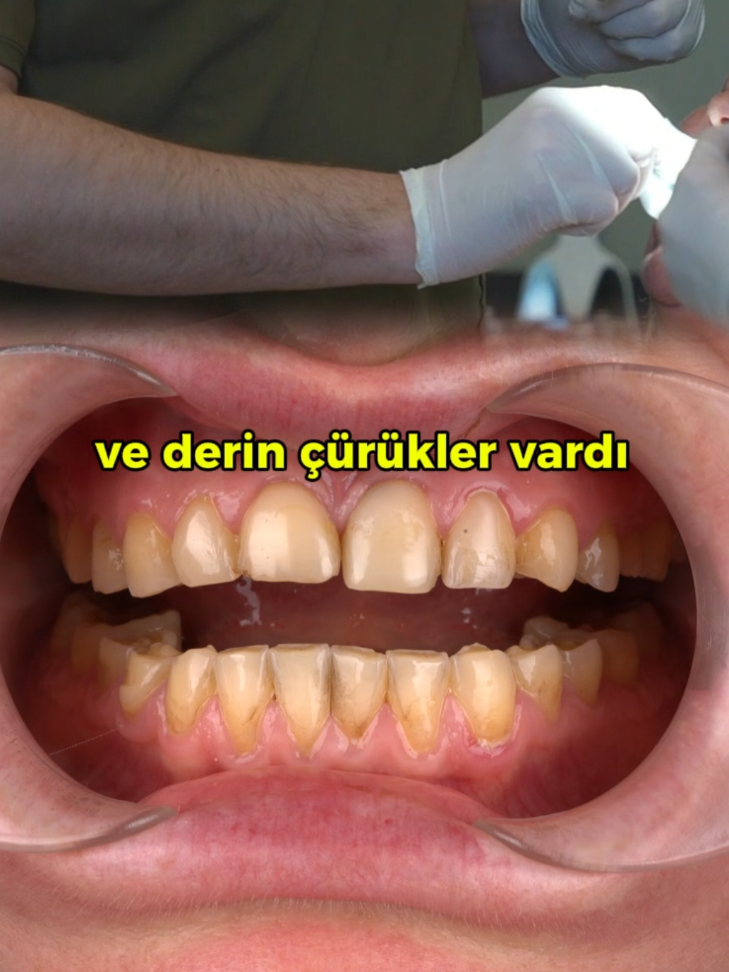 @Doktor Vitrin