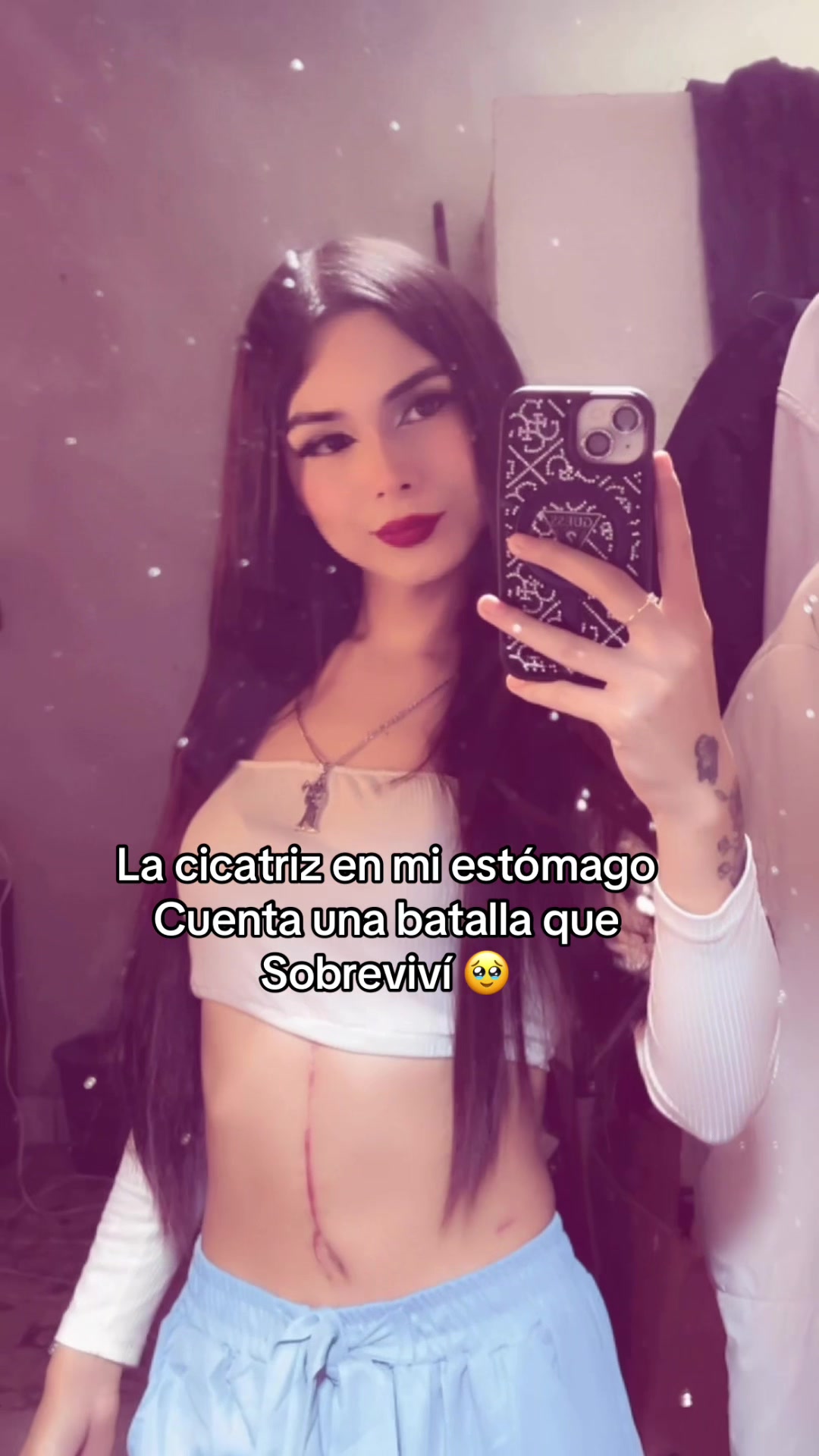 @Ghiromy Castro❣️