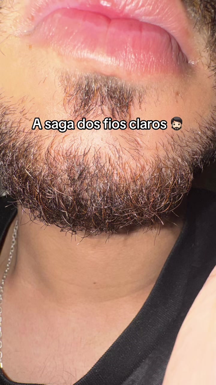 @Pires