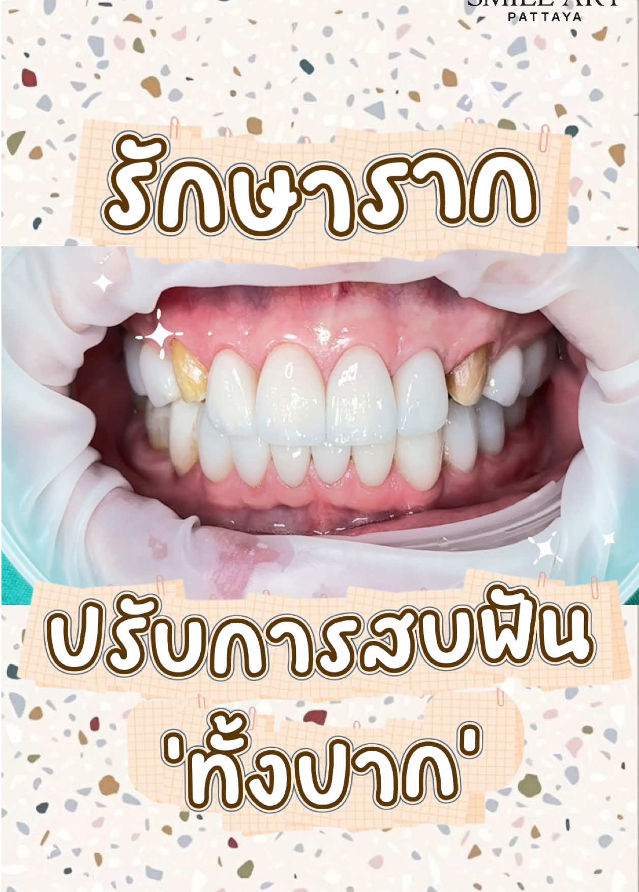 @smile Art Pattaya