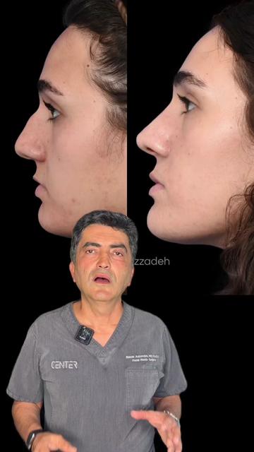 @Babak Azizzadeh