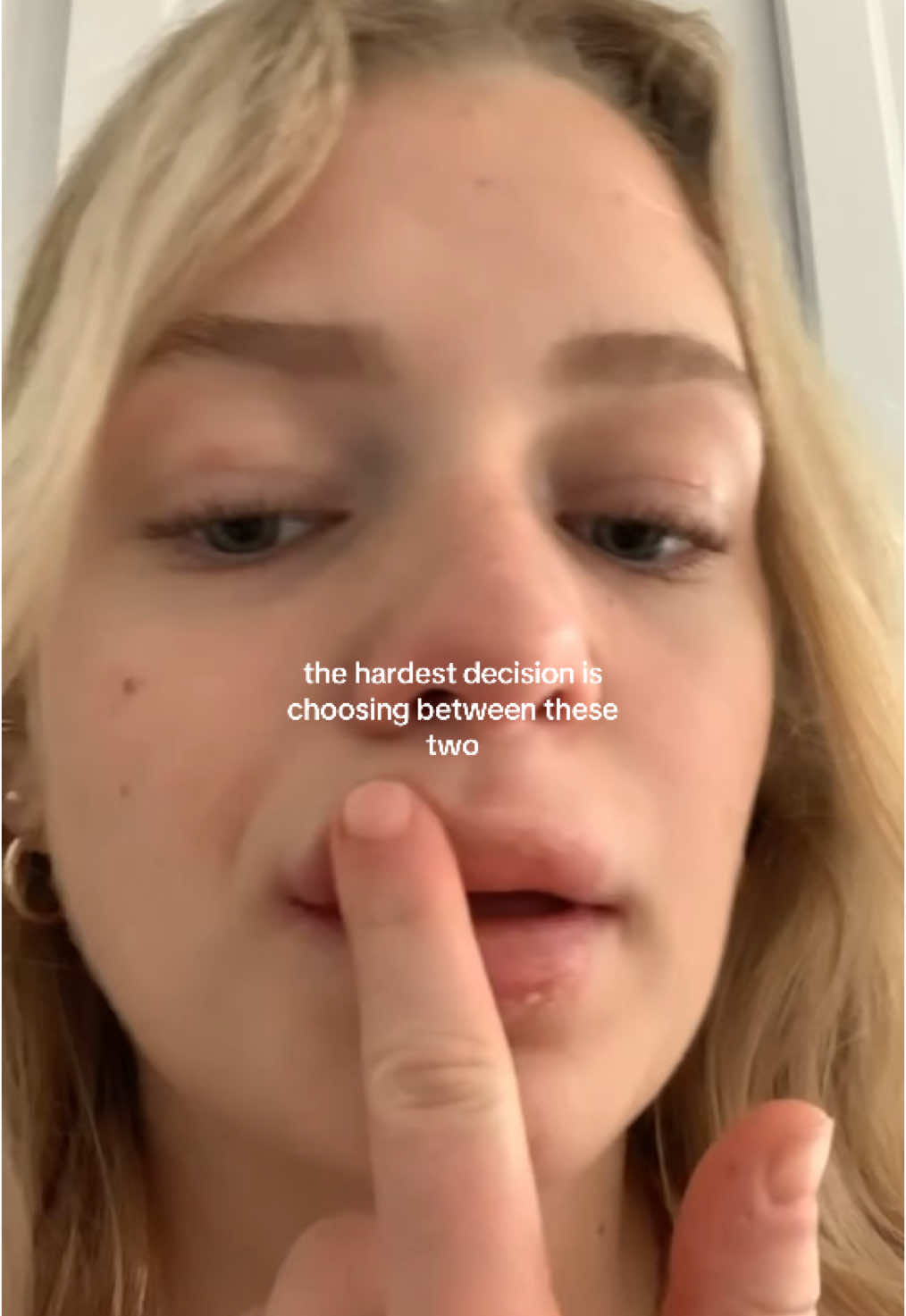 @HOLLYN | CDA 🦷🧚🏼♀️