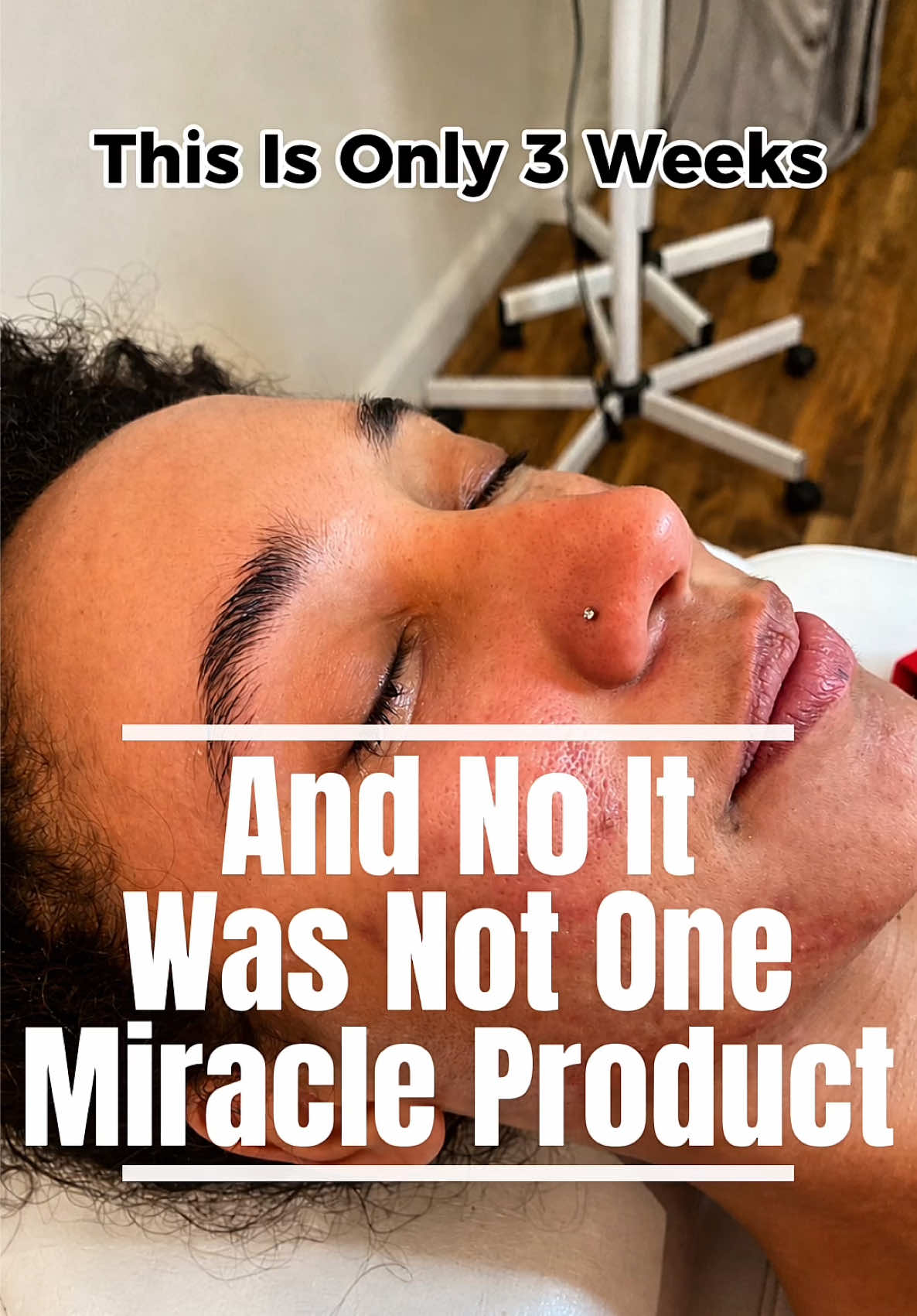 @Andrea | Acne Specialist Jax
