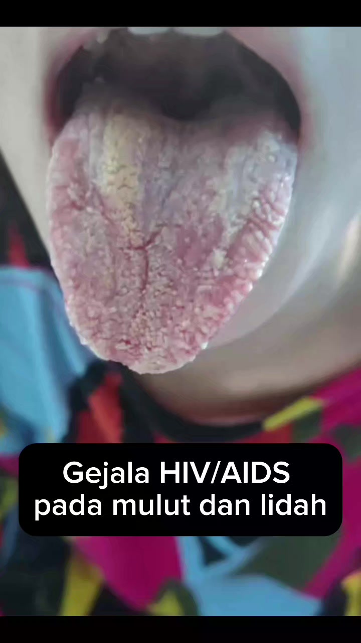 @𝐊𝐫𝐮𝐢 𝐓𝐯