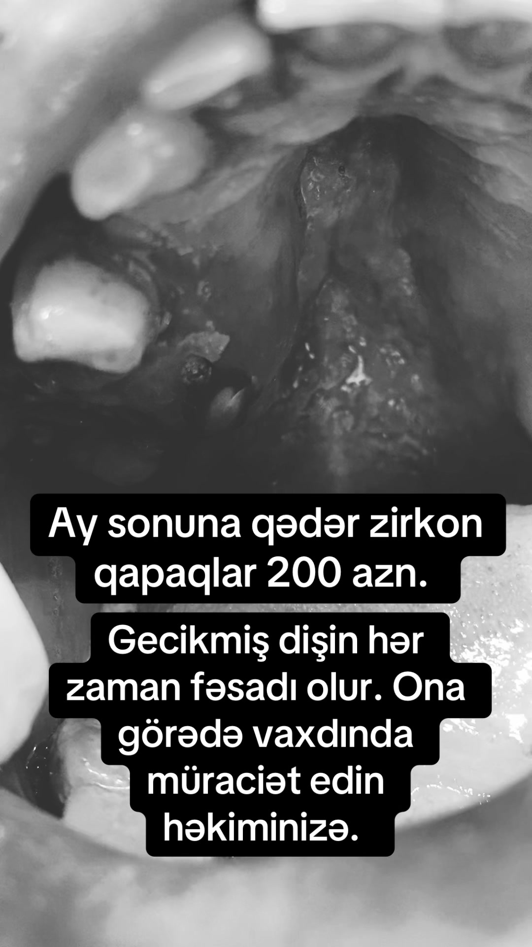 @dr_həmzət__