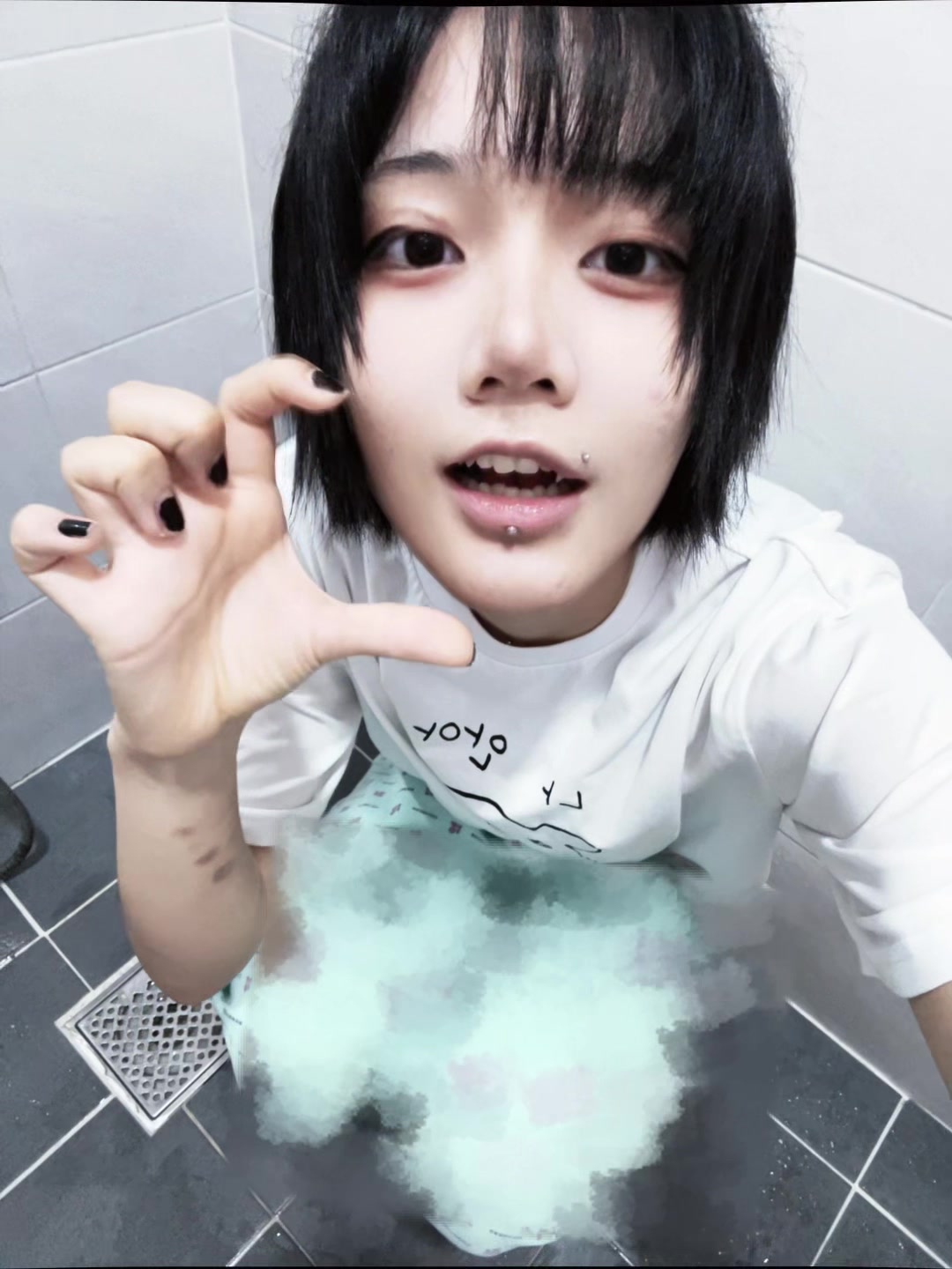 @아프킬레스건