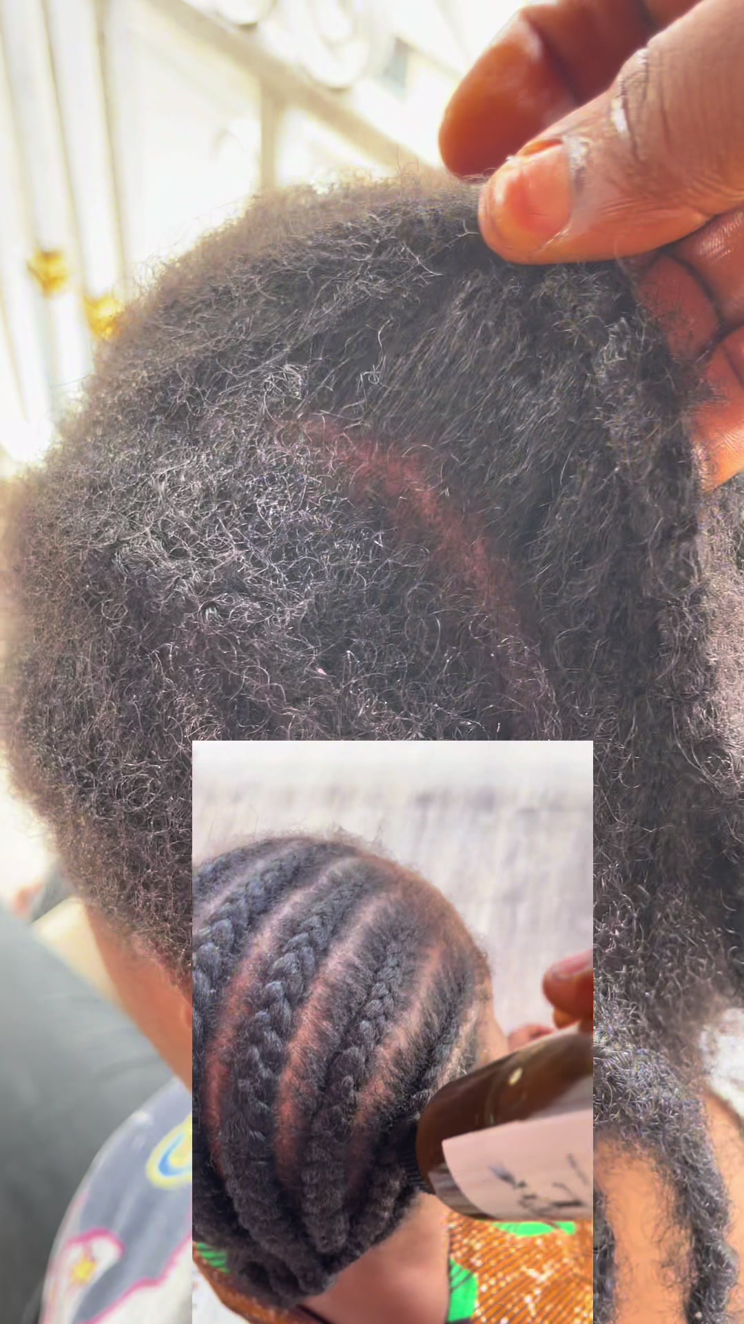 @NO.1HAIR GROWTH PRODUCTS