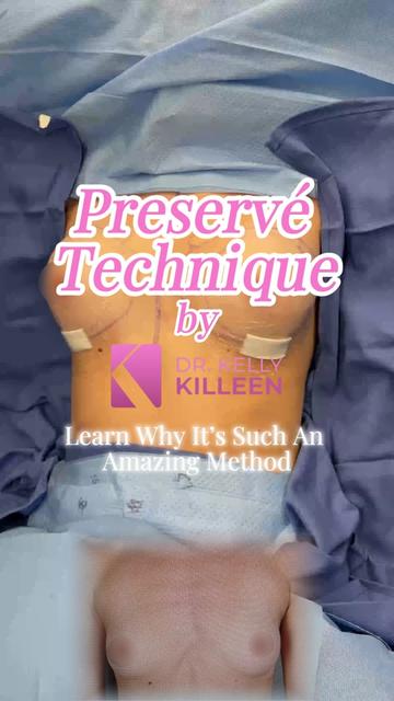 @Kelly&ensp;Killeen,&ensp;MD,&ensp;FACS