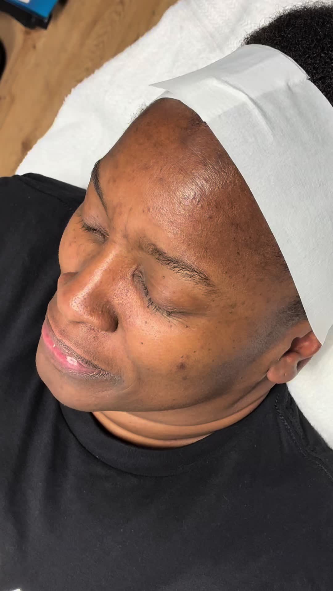 @skiesthetics