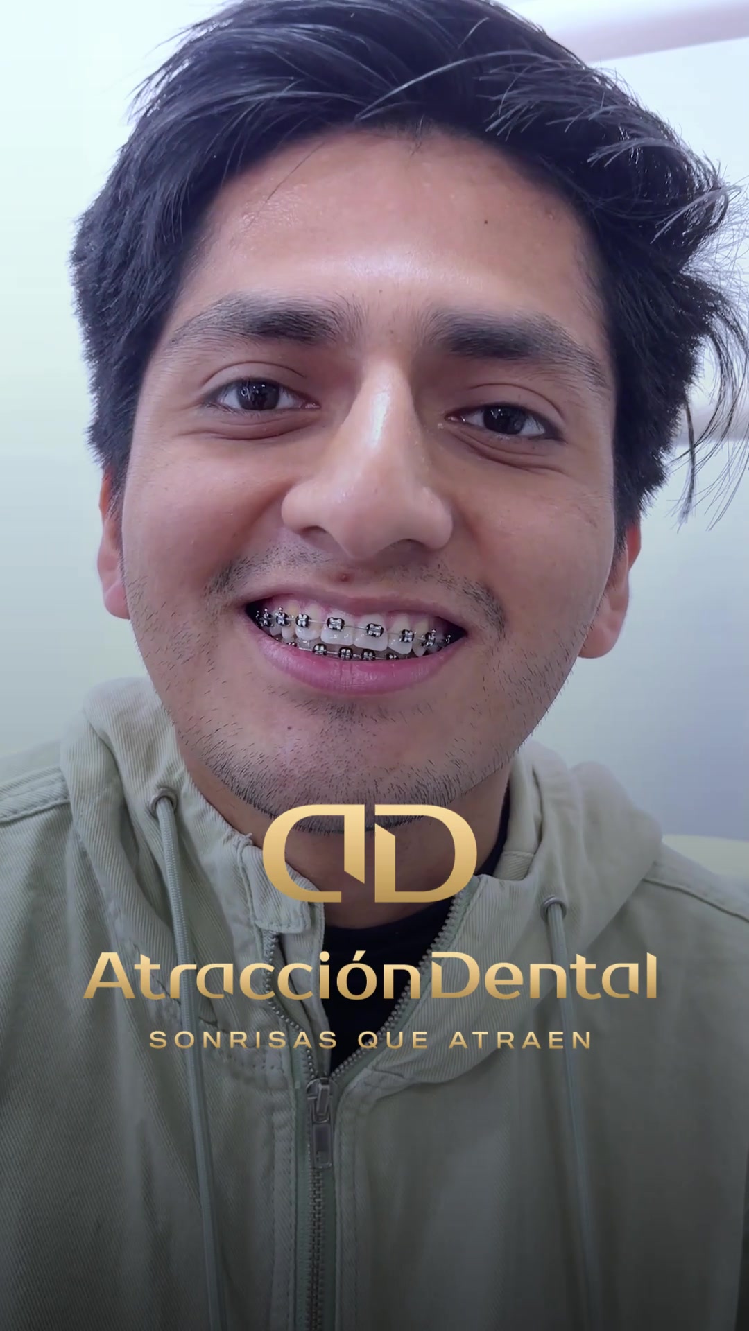 @Brackets y Alineadores