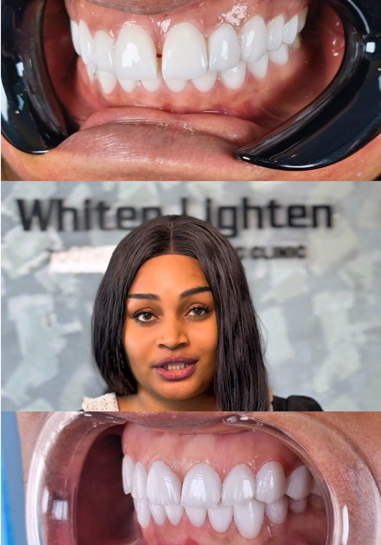 @Whiten Lighten TAC