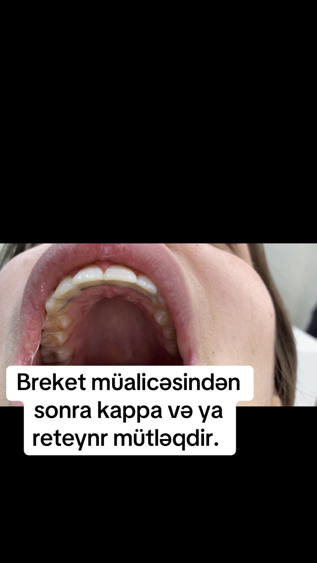 @dr_həmzət__