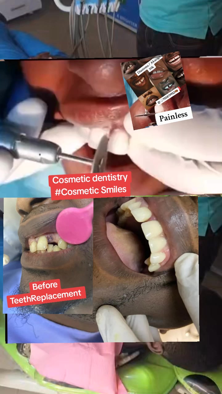 @Allianz Dental studio🦷🦷🇺🇬