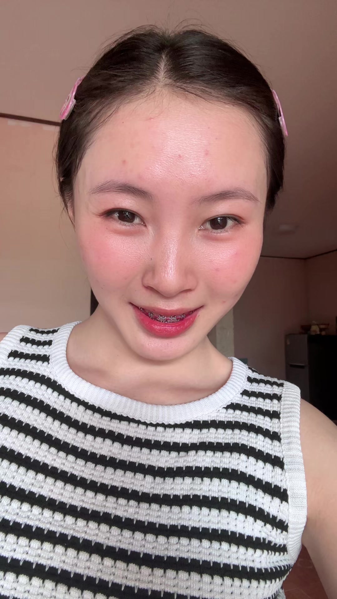 @陆娜（ອາລຸນລັກ🌷)