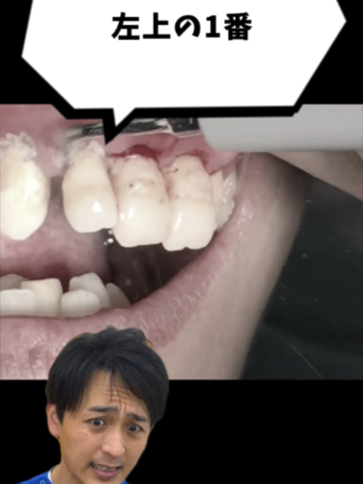 @金歯先生☆歯医者