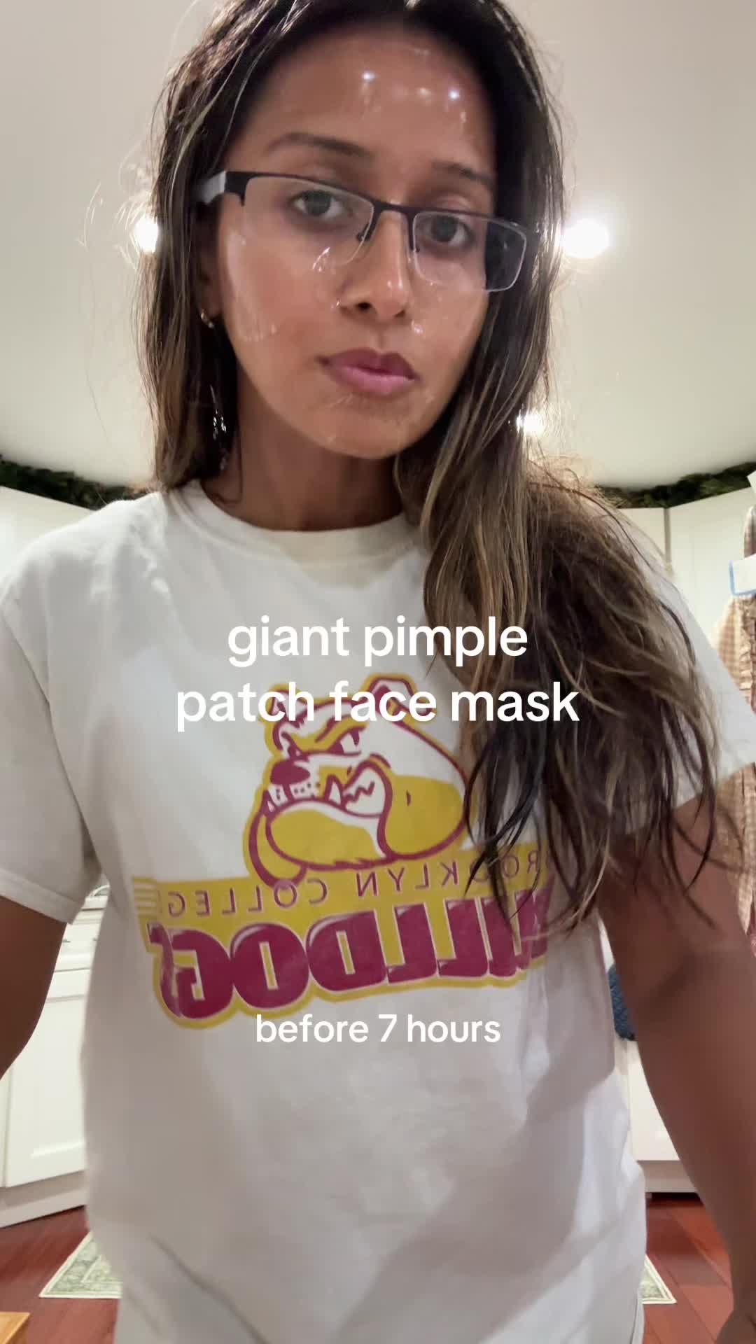 @GND
