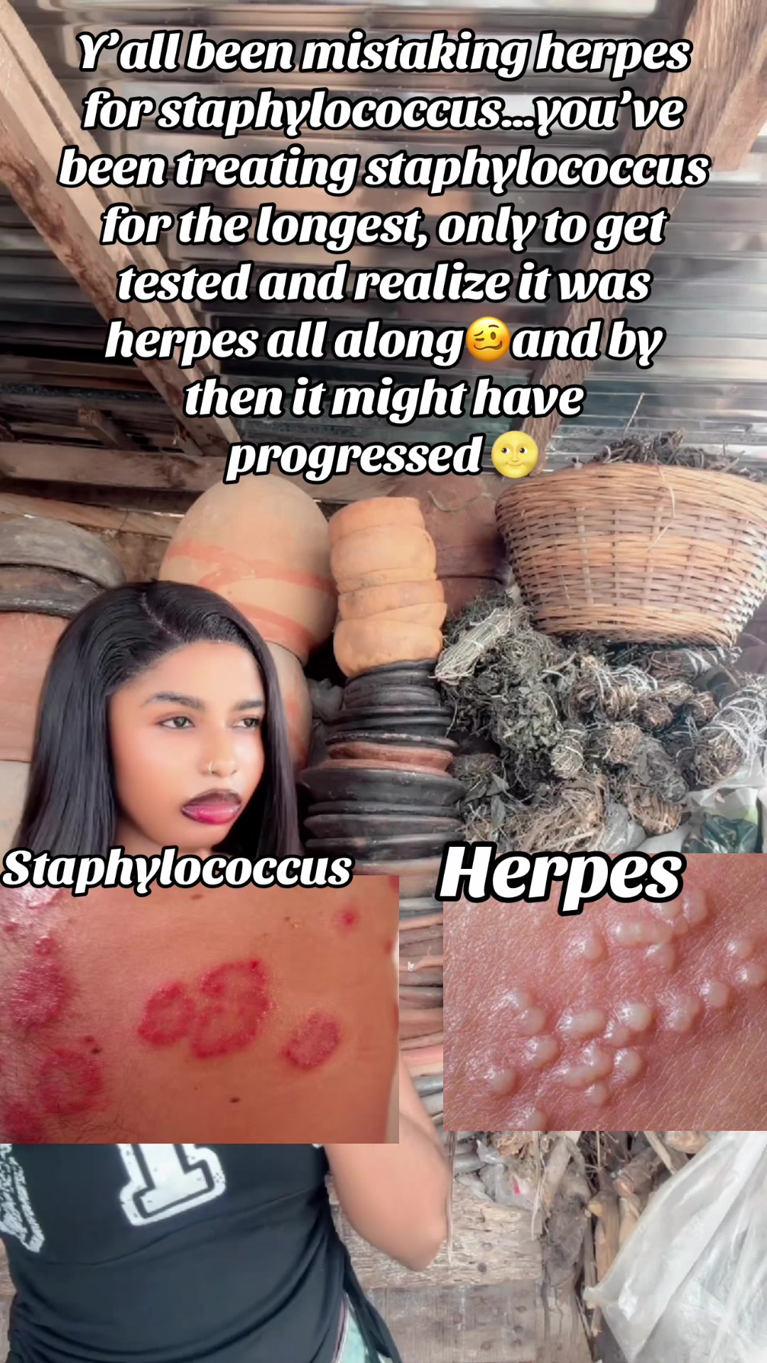 @GeNz_alagbo🐍🍯