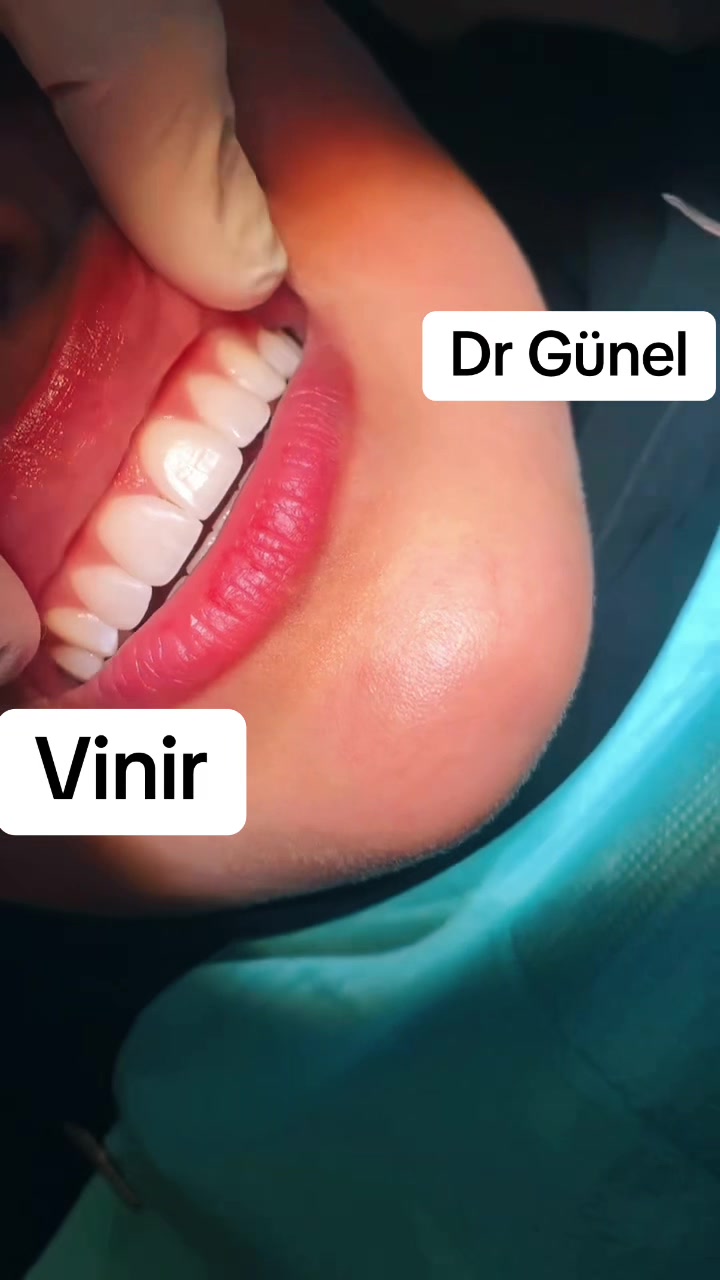 @Dentist_Günel