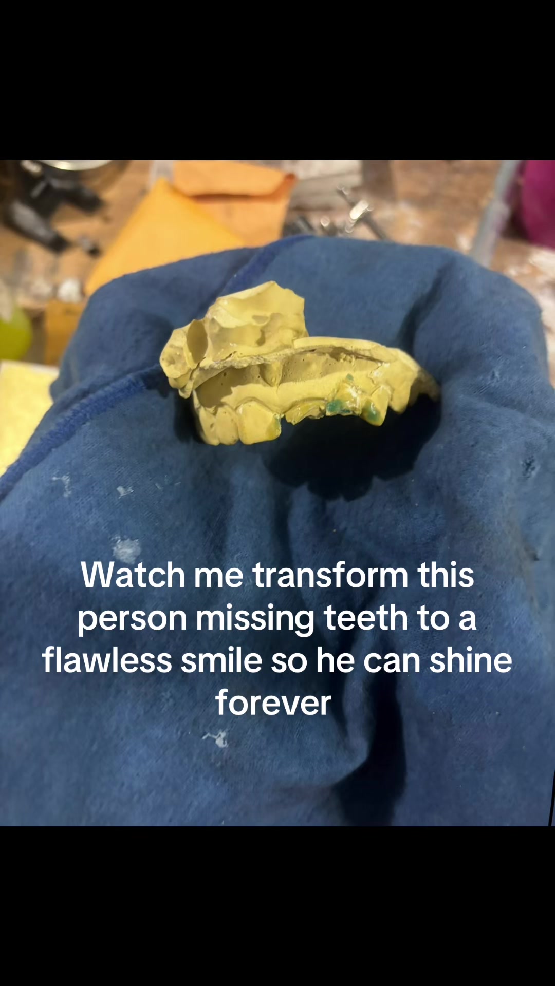 @Flawless Grillz