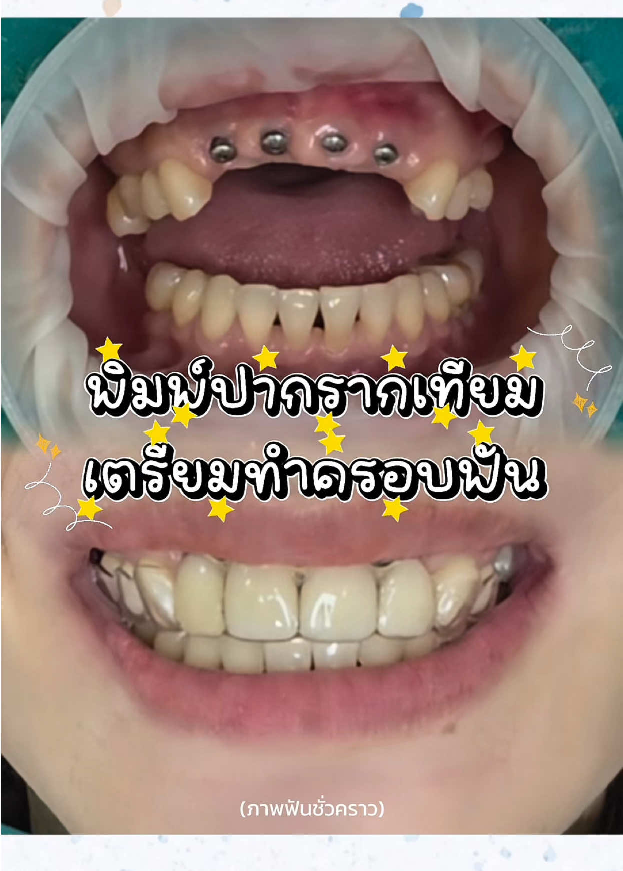 @smile Art Pattaya