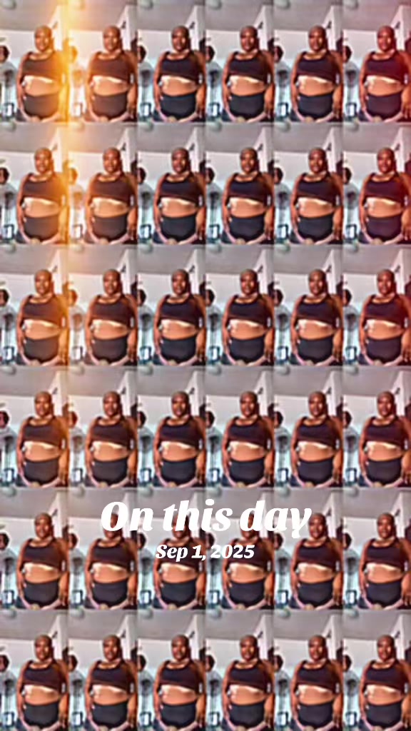 @Thevitiligogirl