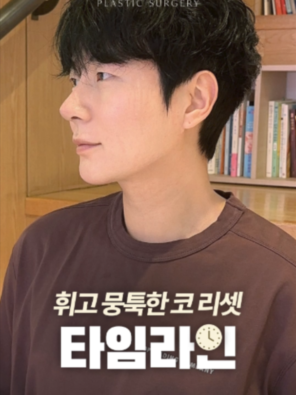 @리셋성형외과