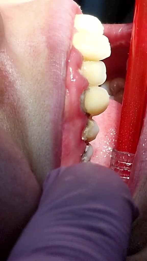 @Dr otmani. A 🦷🖤