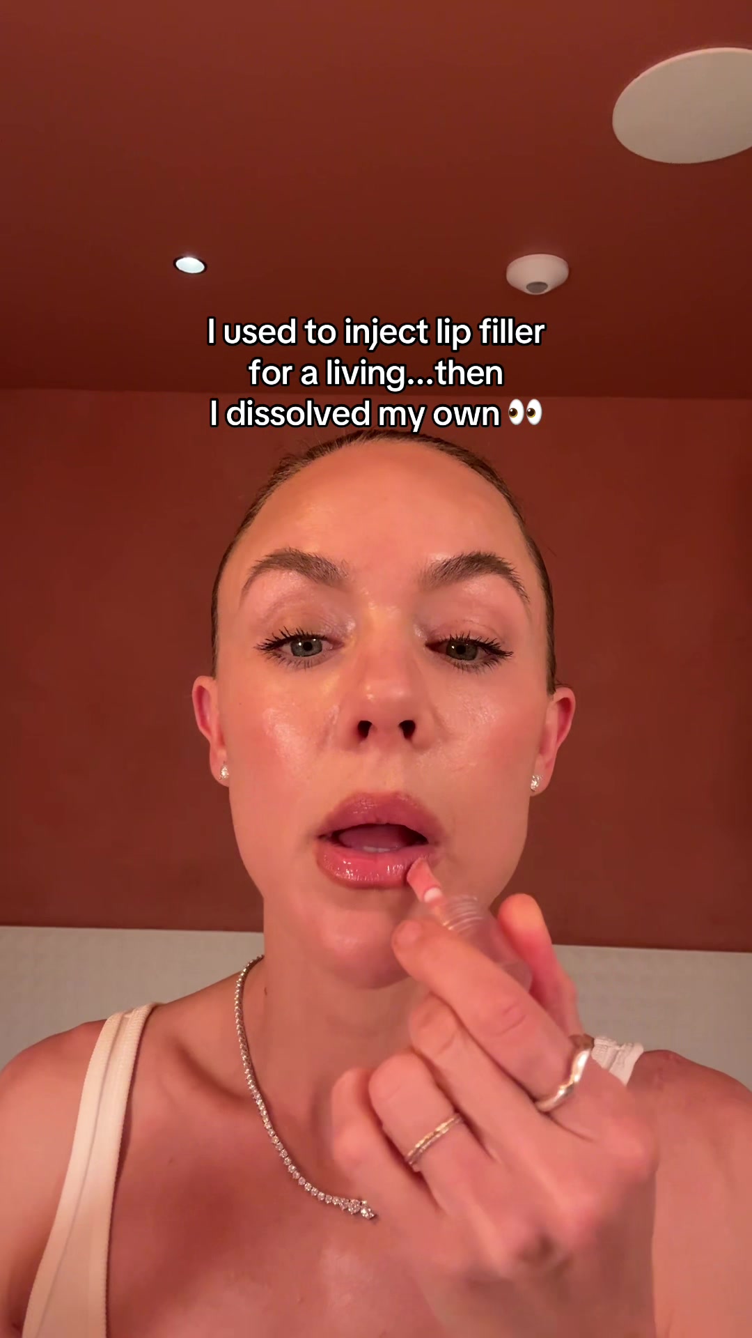 @Celeste | RN acne expert