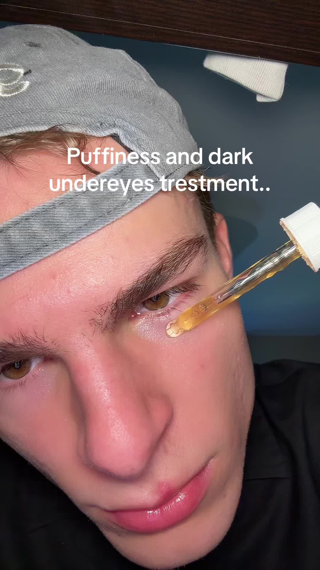 @Finn