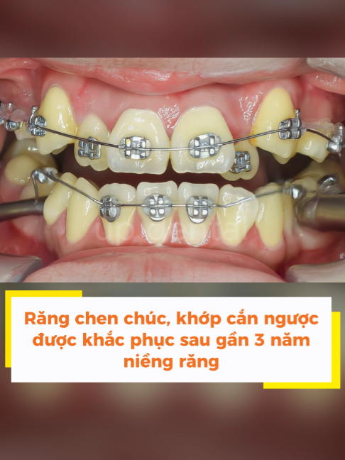 @Nha khoa niềng răng Up Dental