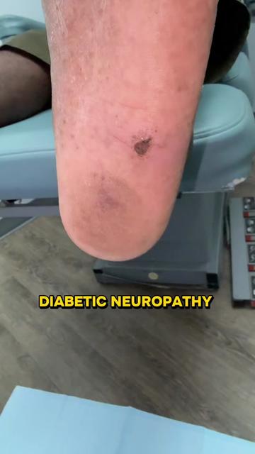 @Deniel Foot and Ankle Center