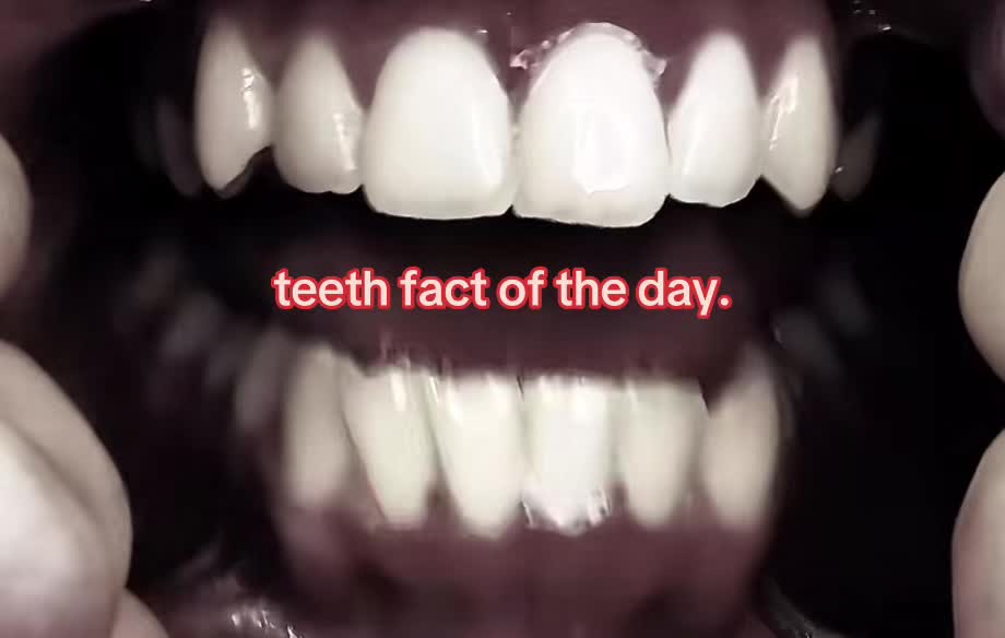 @I leik teeth moer thna mysefl.