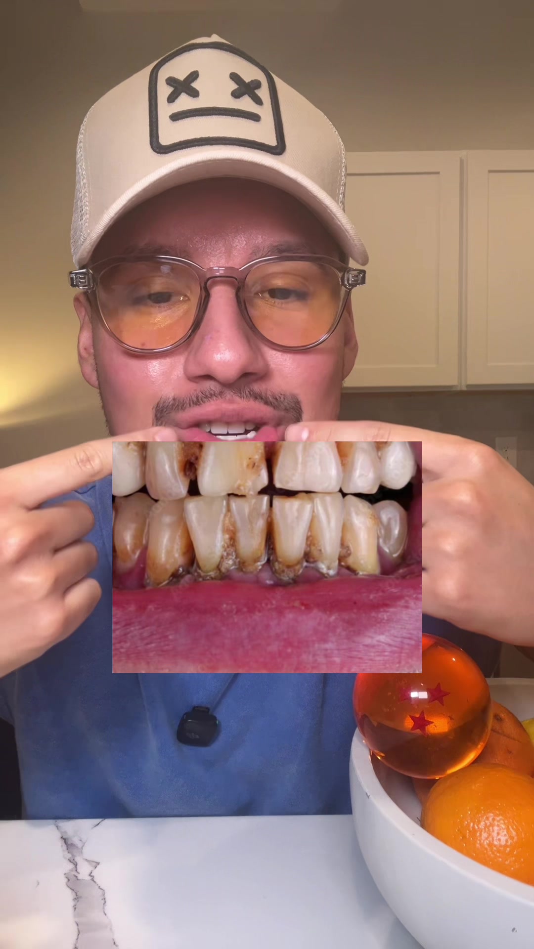 @Chinotiktokdeals