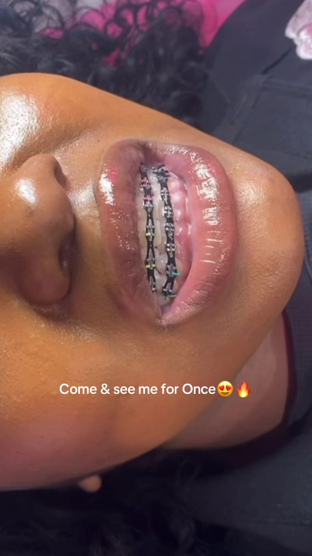 @bracesjunkie