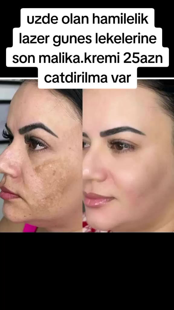 @gozellik_mekani