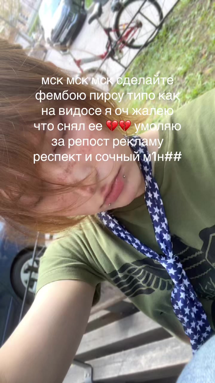 @kiss7day
